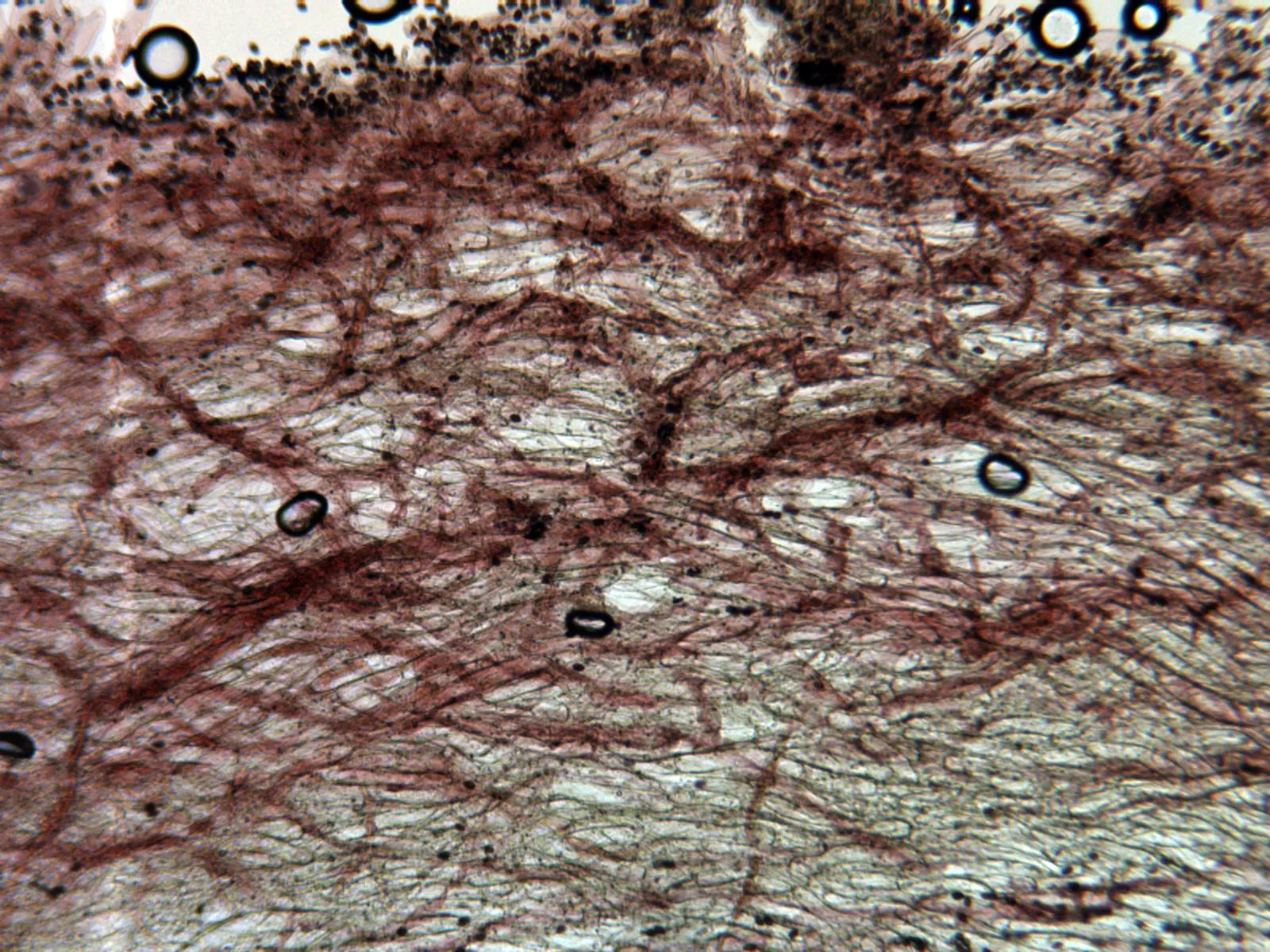 Microscopía de Panaeolus fimicola - 14 - Sección pileipellis x 100